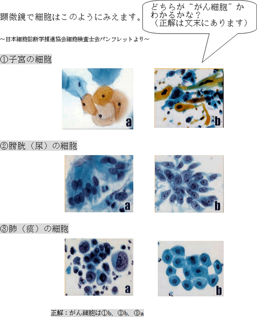 �זE�f�����ɂ��āI